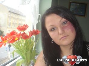 poczkowa